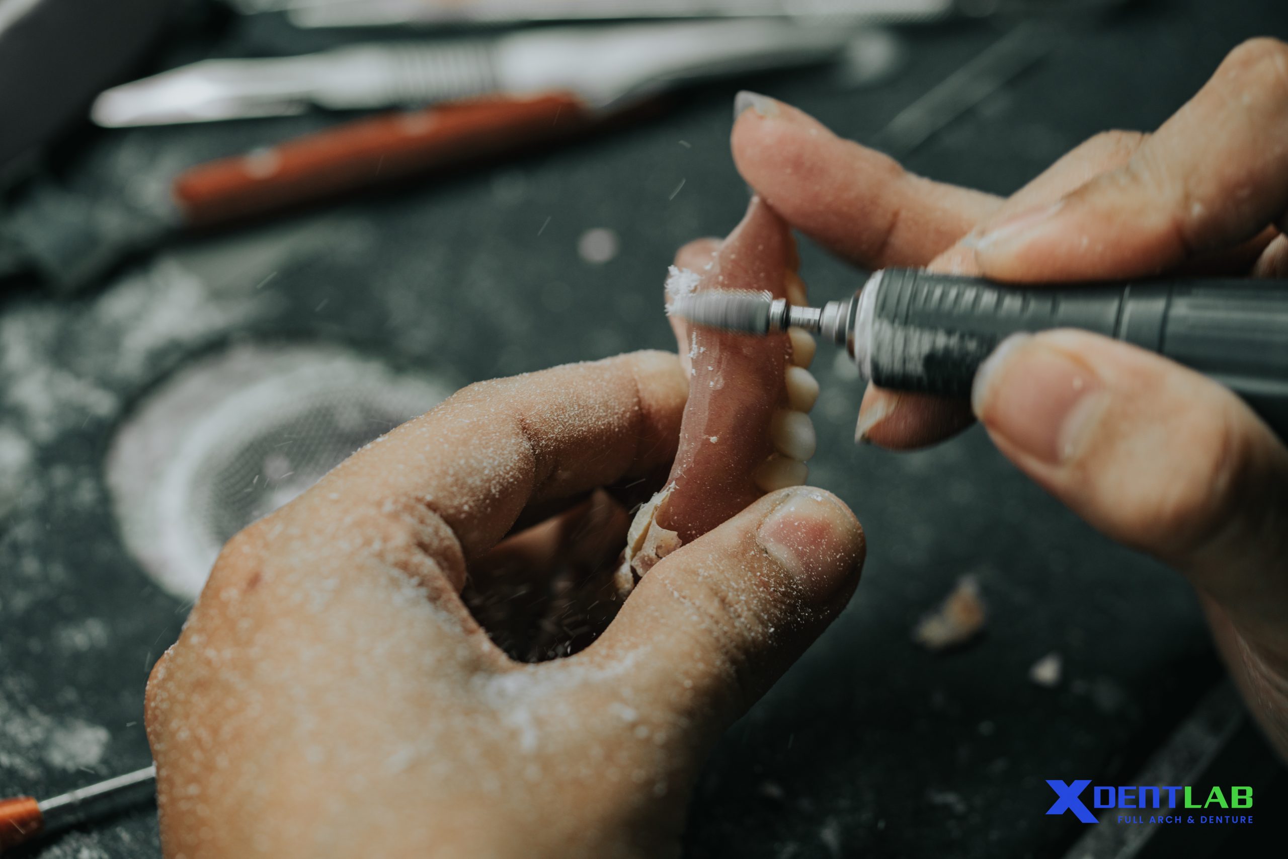 Top Dental Outsourcing Tips: Common Mistakes to Avoid