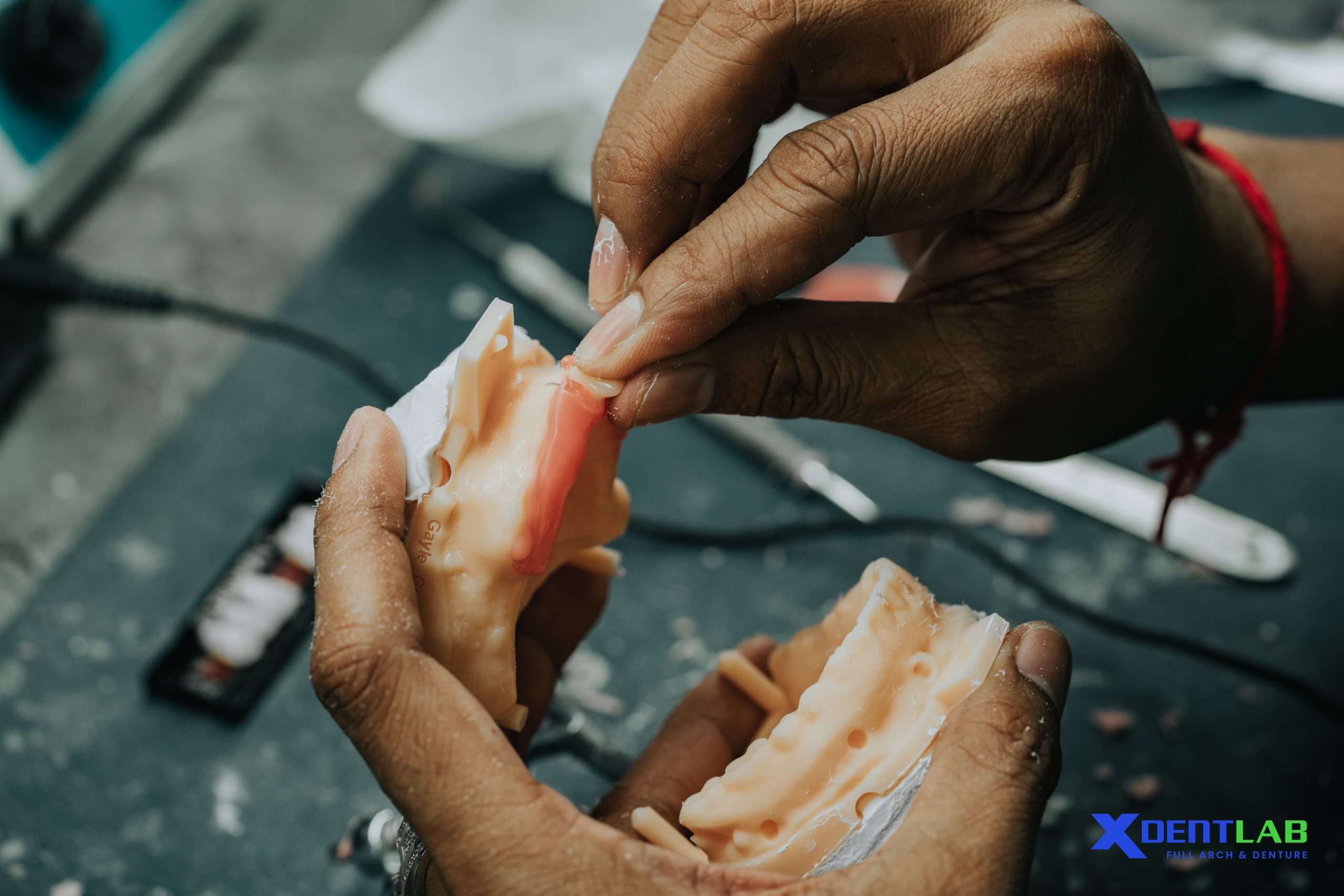 Dental Lab Outsourcing Vietnam 