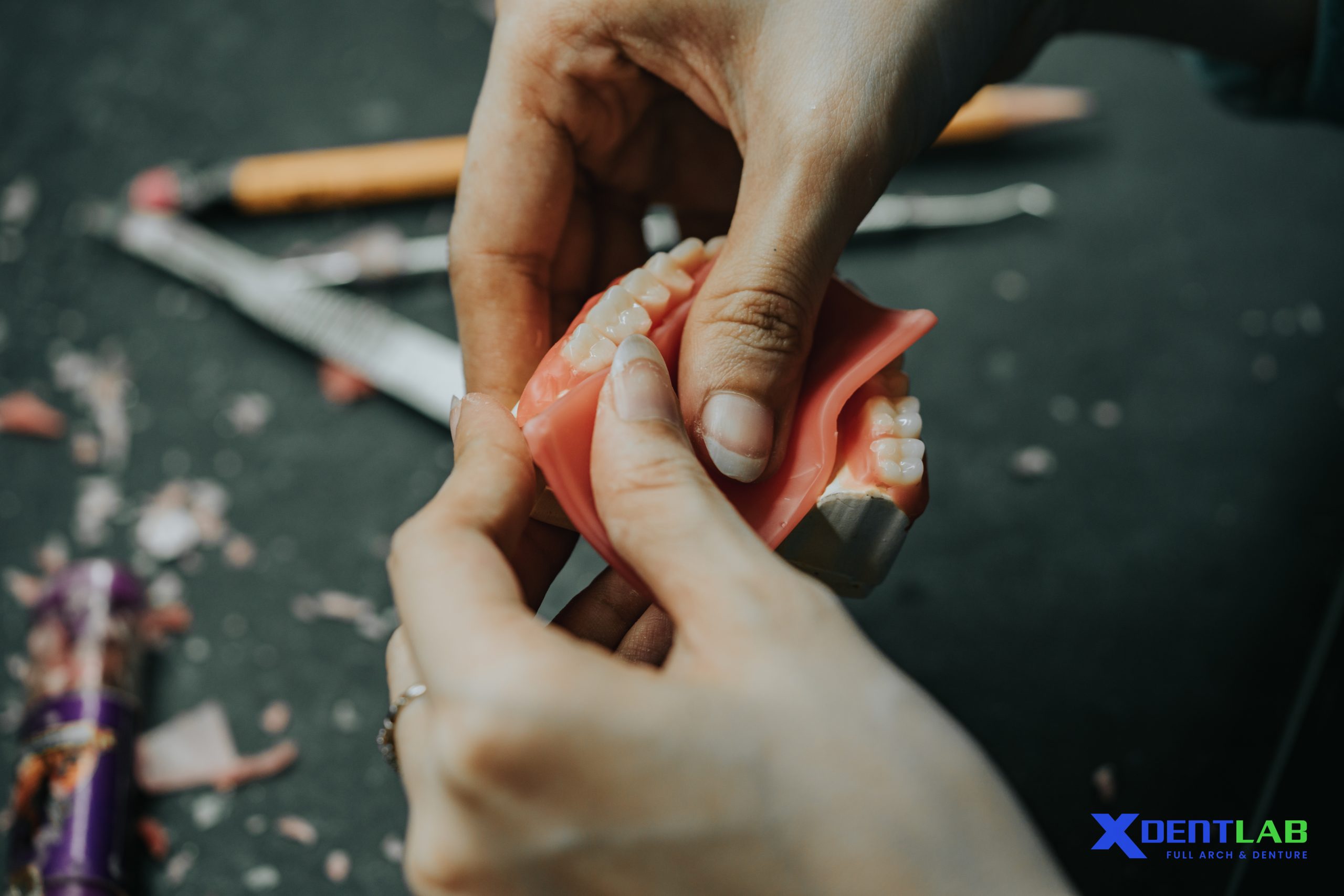 Vietnam Dental Lab Benefits – Why U.S. Clinics Choose XDENT LAB
