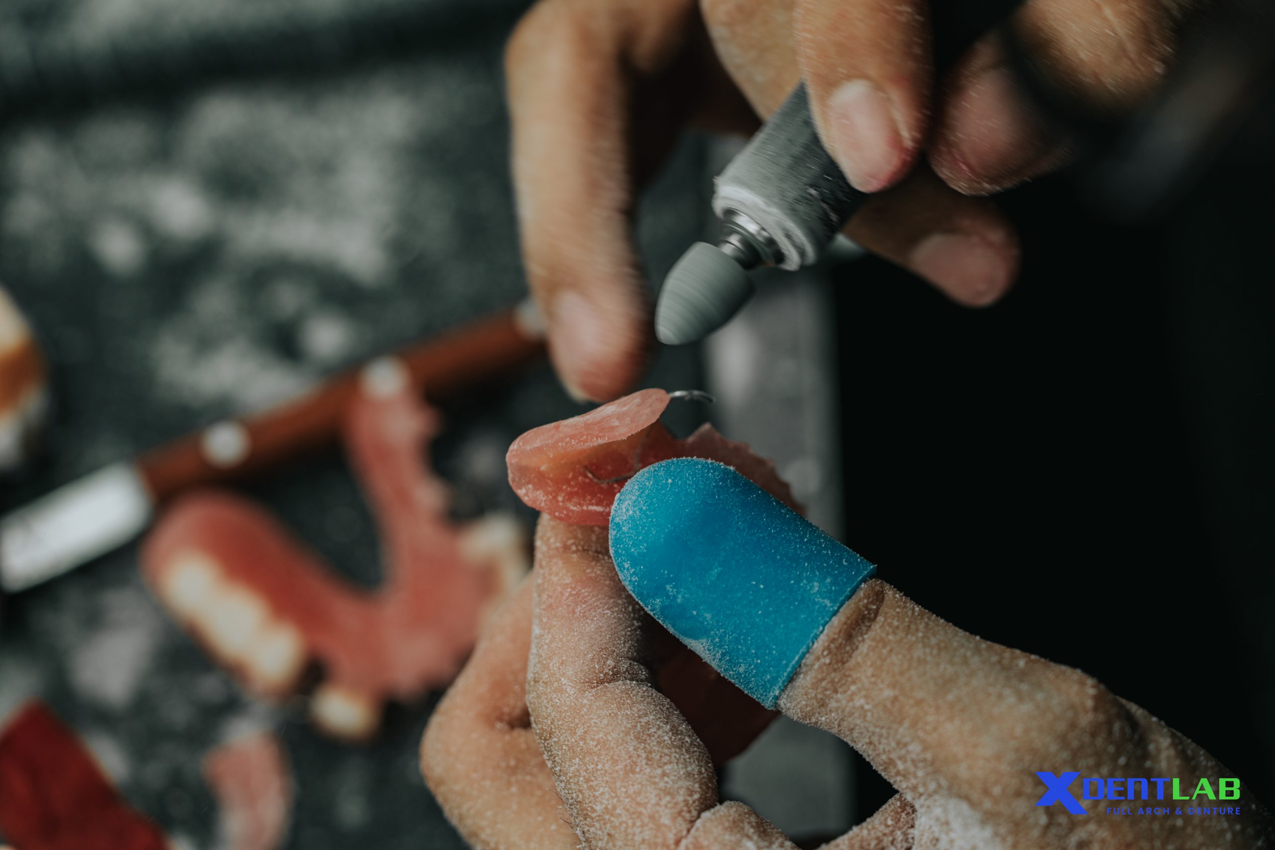 What to Expect in Dental Lab Communication with a Vietnam - Based Partner