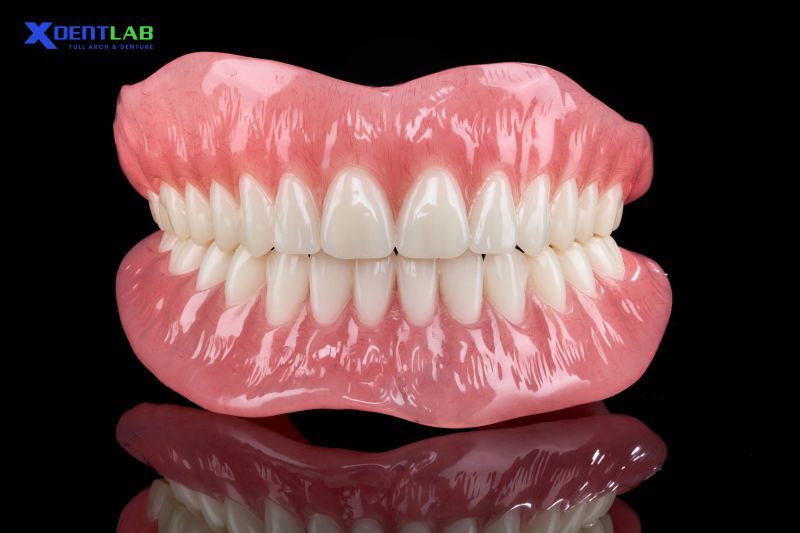 How to Minimize Delays When Outsourcing Full Arch Restorations