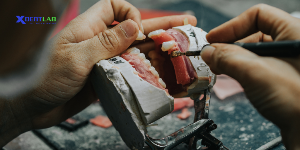 Trial Restoration Dental Outsourcing – Everything You Should Know